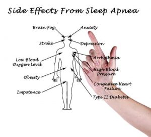 stewart-sleep-apnea
